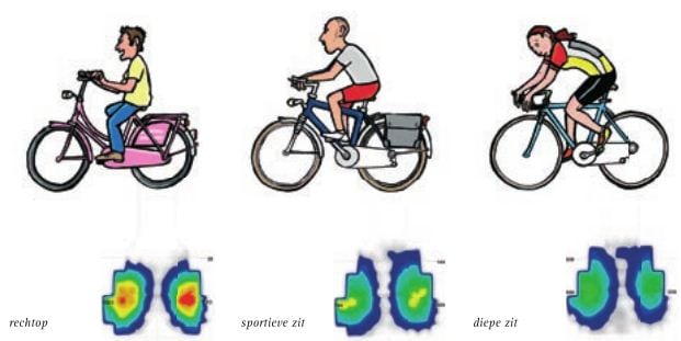 Zadelpijn na het fietsen: pijn aan stuitje 2 zadelpijn