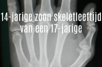 14-jarige zoon skelet leeftijd van een 17-jarige