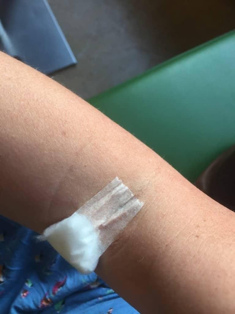 Controleren op ziekte van Lyme + uitslag 1 ziekte van Lyme
