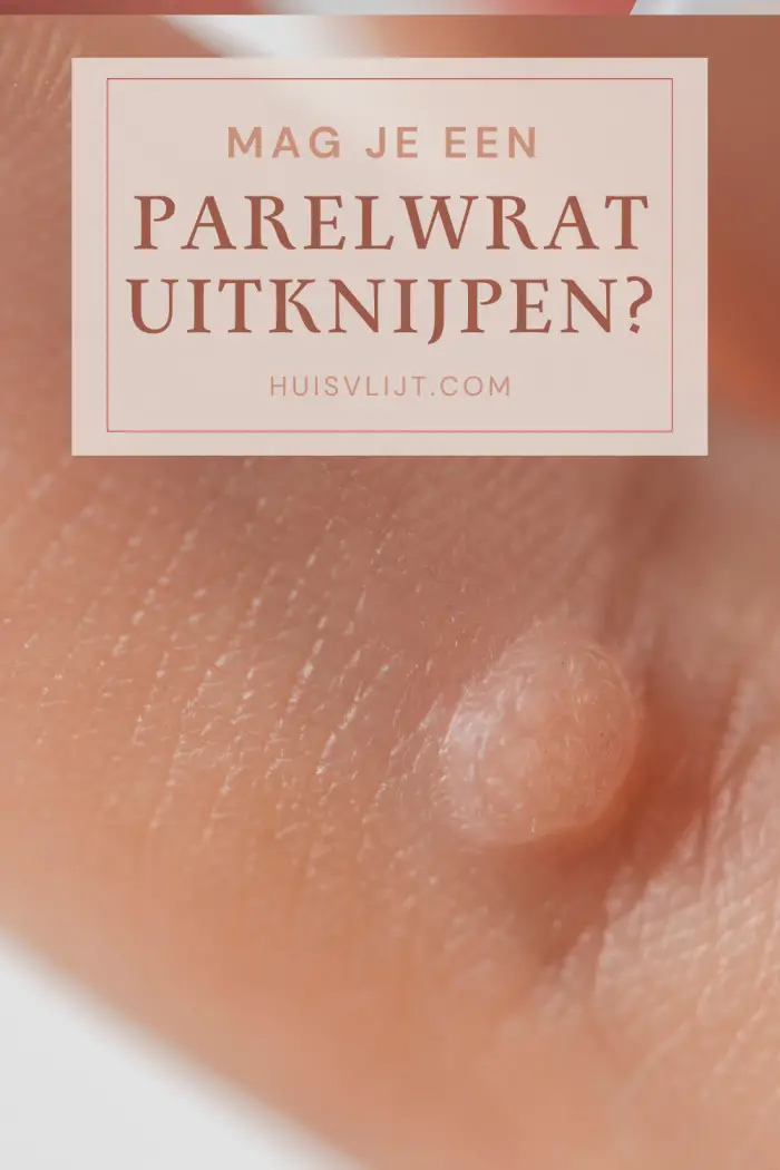 parelwratjes uitknijpen
