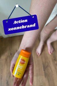 action zonnebrand