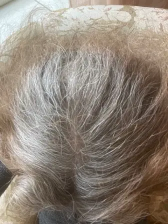 grijze haren krijgen