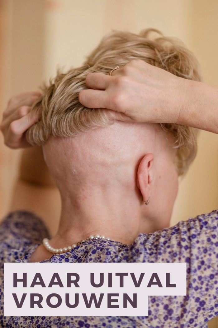 haar uitval vrouwen